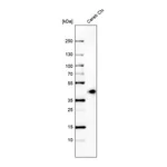 Atlas Antibodies Anti-B3GAT1 Antibody