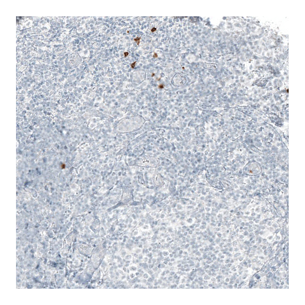 Atlas Antibodies Anti-B3GAT1 Antibody