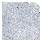 Atlas Antibodies Anti-B3GAT1 Antibody