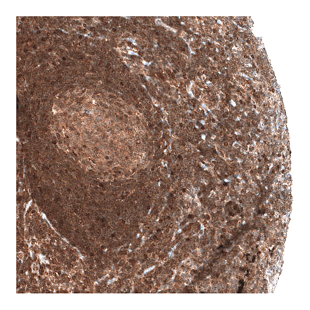 Atlas Antibodies Anti-BAX Antibody