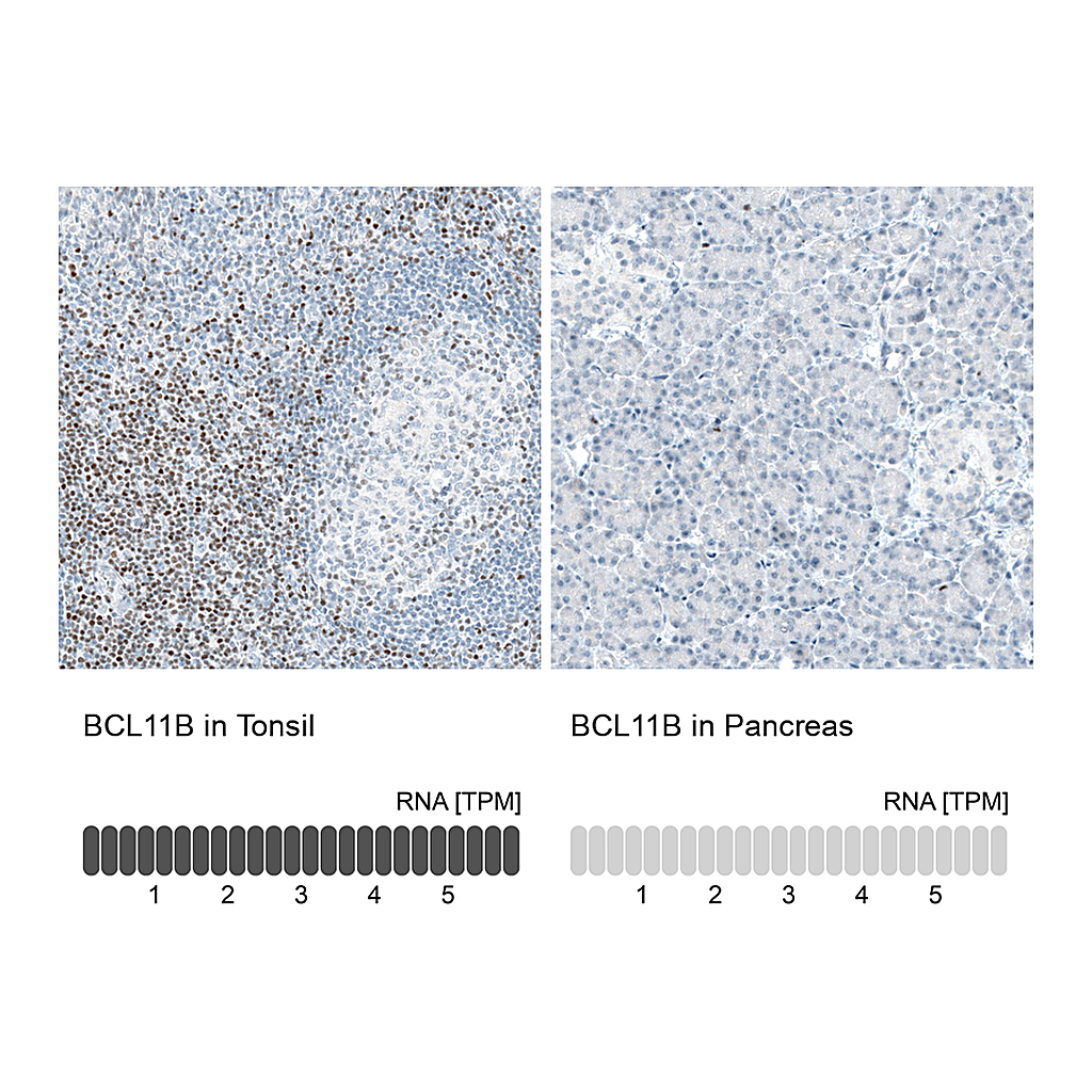 Atlas Antibodies Anti-BCL11B Antibody