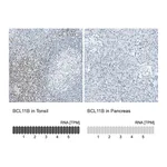 Atlas Antibodies Anti-BCL11B Antibody