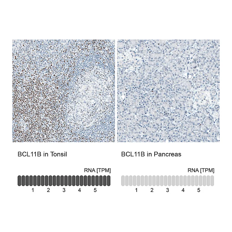 Atlas Antibodies Anti-BCL11B Antibody