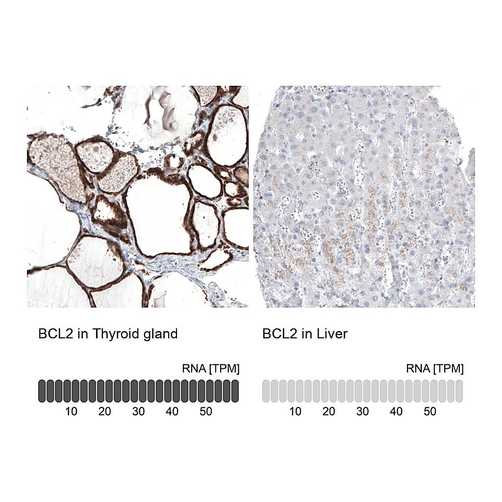 Atlas Antibodies Anti-BCL2 Antibody