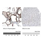 Atlas Antibodies Anti-BCL2 Antibody