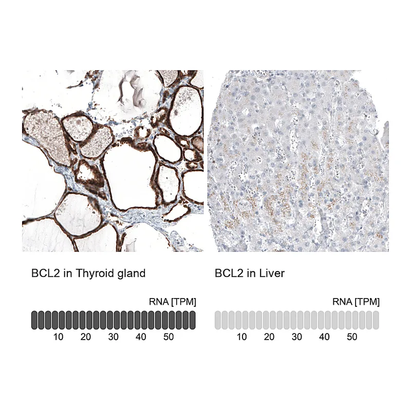Atlas Antibodies Anti-BCL2 Antibody