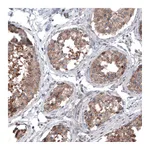 Atlas Antibodies Anti-BRAF Antibody