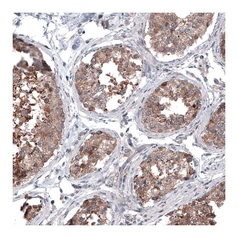 Atlas Antibodies Anti-BRAF Antibody