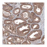 Atlas Antibodies Anti-BRAF Antibody