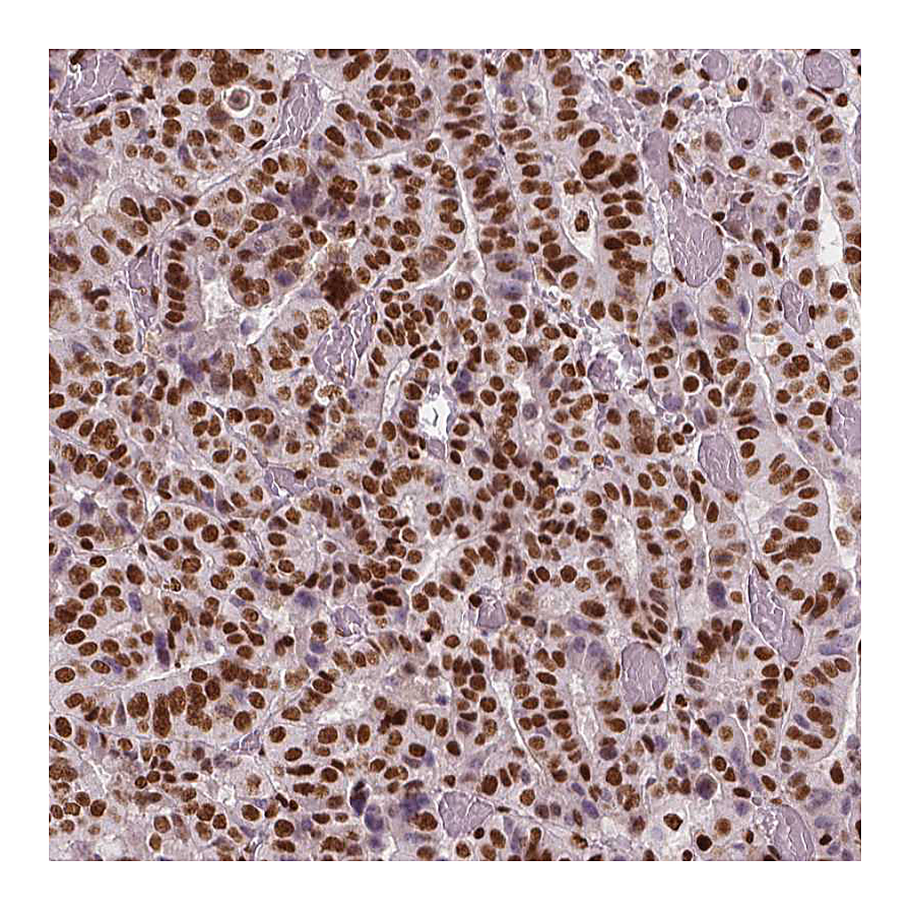 Atlas Antibodies Anti-BRD4 Antibody