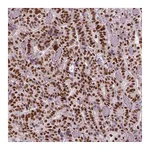 Atlas Antibodies Anti-BRD4 Antibody
