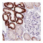 Atlas Antibodies Anti-CA12 Antibody