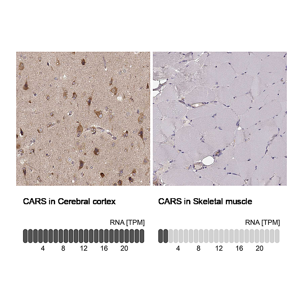 Atlas Antibodies Anti-CARS Antibody