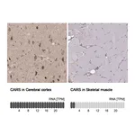 Atlas Antibodies Anti-CARS Antibody