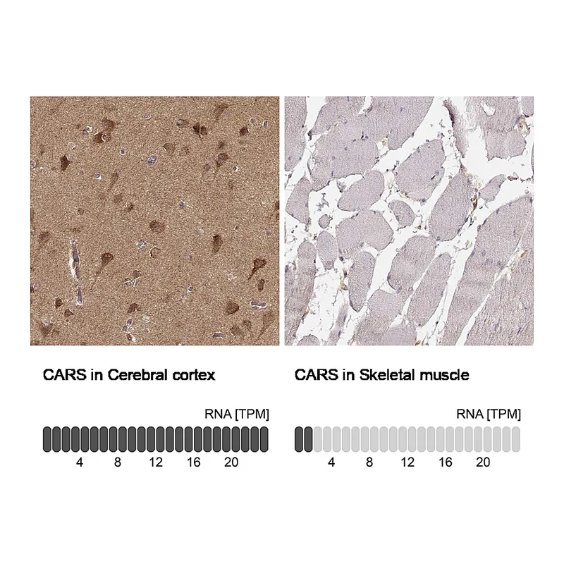 Atlas Antibodies Anti-CARS Antibody