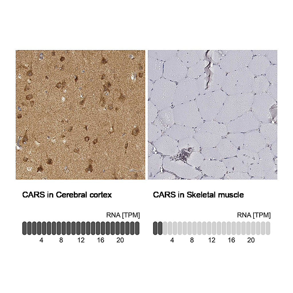 Atlas Antibodies Anti-CARS Antibody
