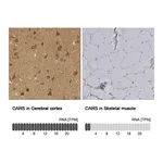 Atlas Antibodies Anti-CARS Antibody