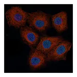 Atlas Antibodies Anti-CCND1 Antibody