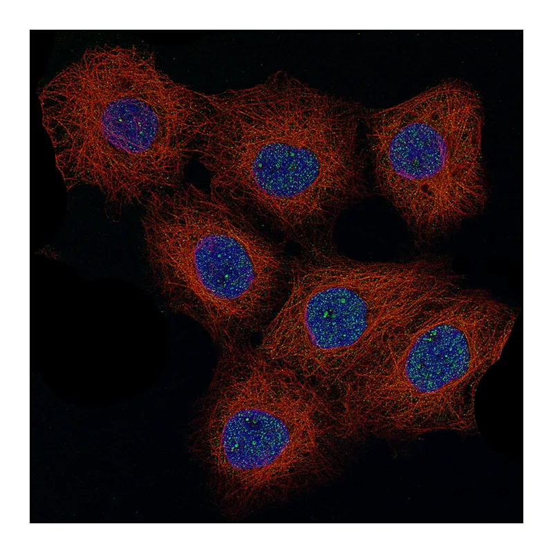 Atlas Antibodies Anti-CCND1 Antibody