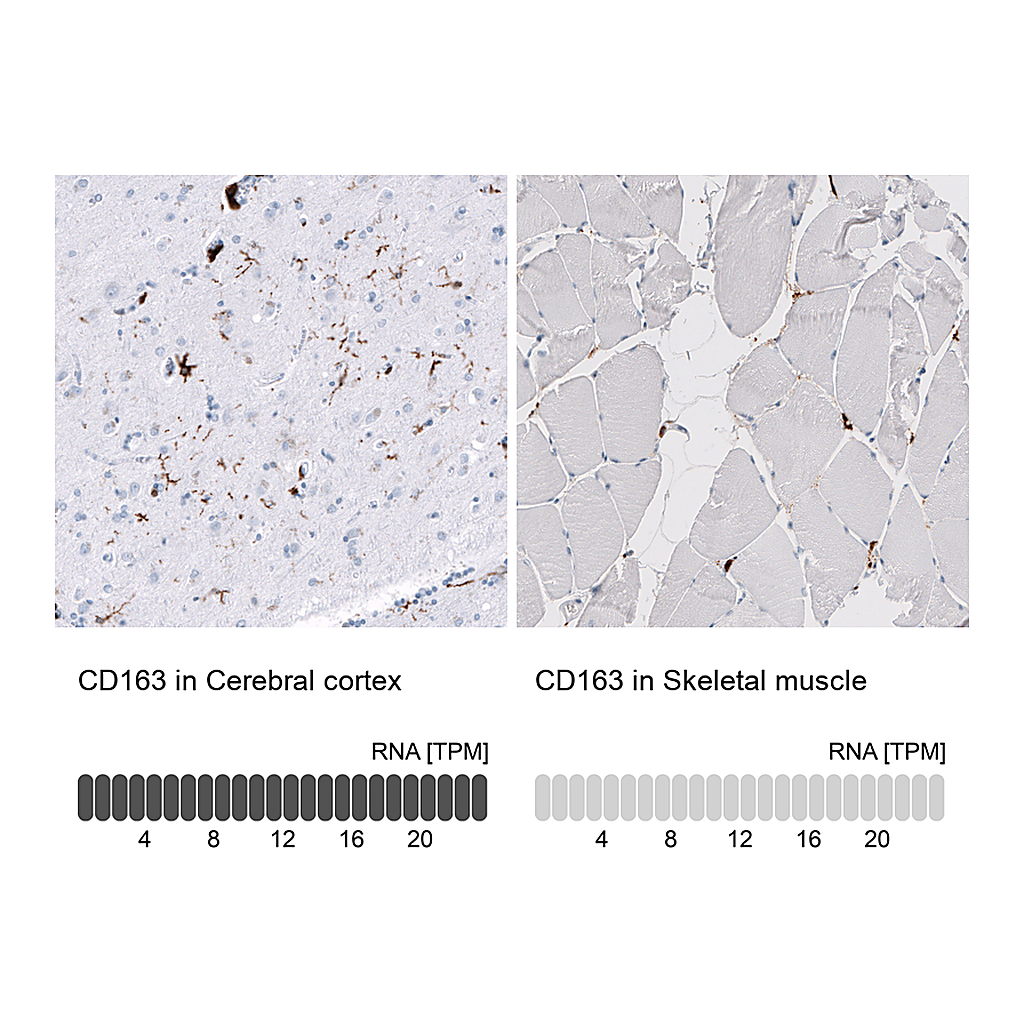 Atlas Antibodies Anti-CD163 Antibody
