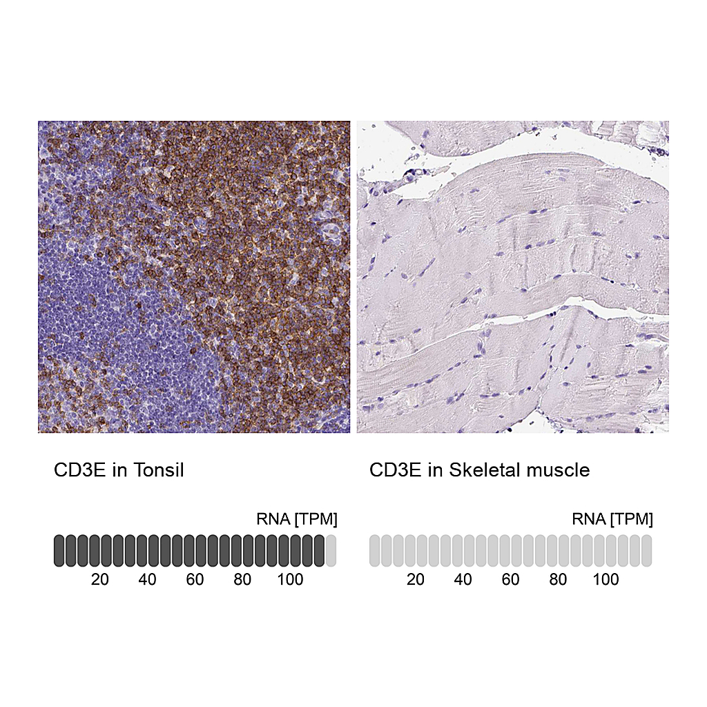 Atlas Antibodies Anti-CD3E Antibody