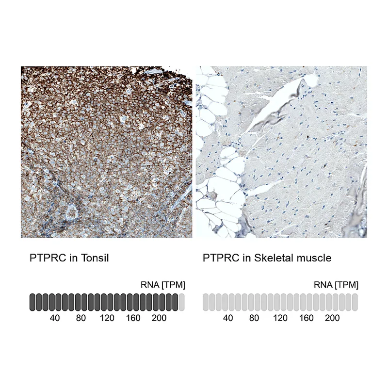 Atlas Antibodies Anti-CD45 Antibody