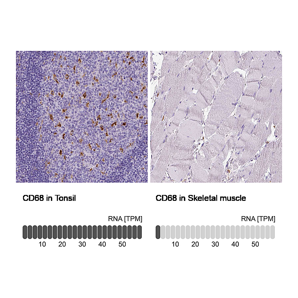 Atlas Antibodies Anti-CD68 Antibody