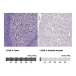 Atlas Antibodies Anti-CD68 Antibody
