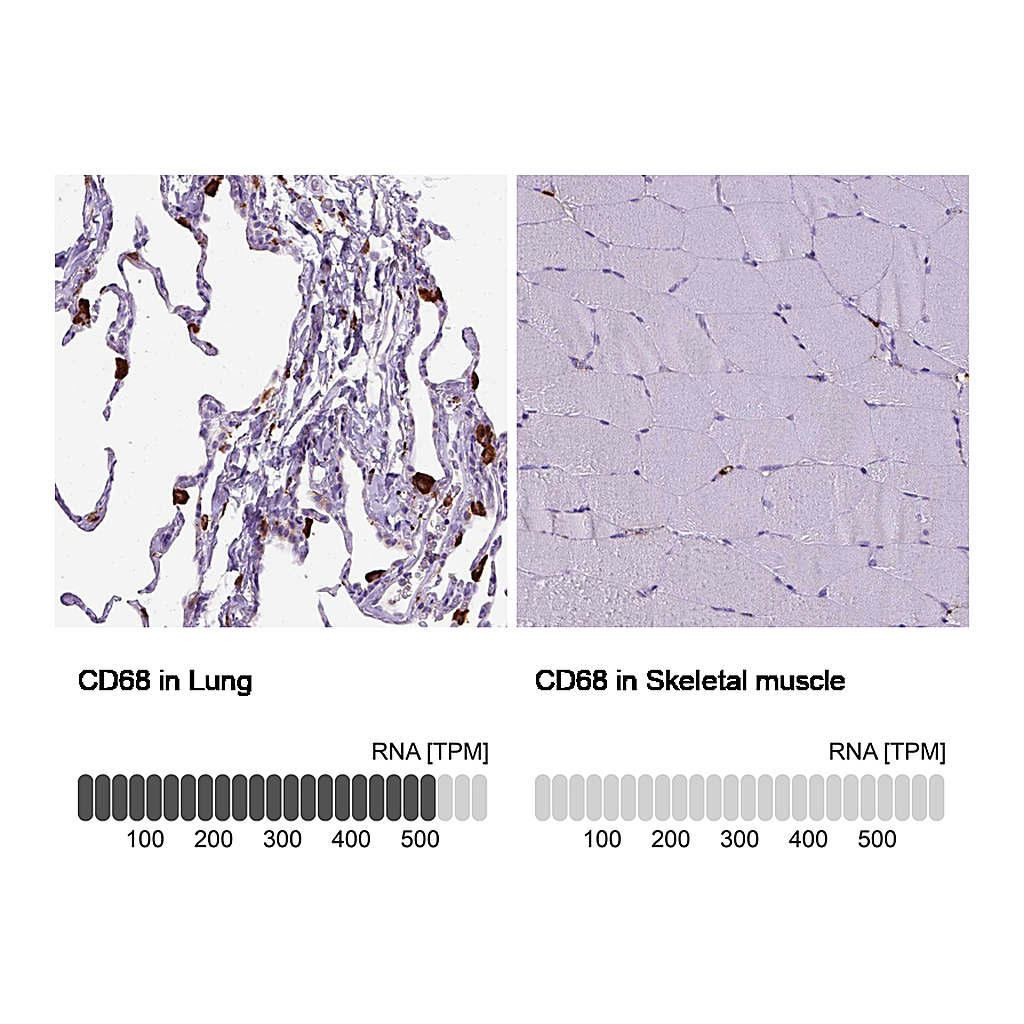 Atlas Antibodies Anti-CD68 Antibody