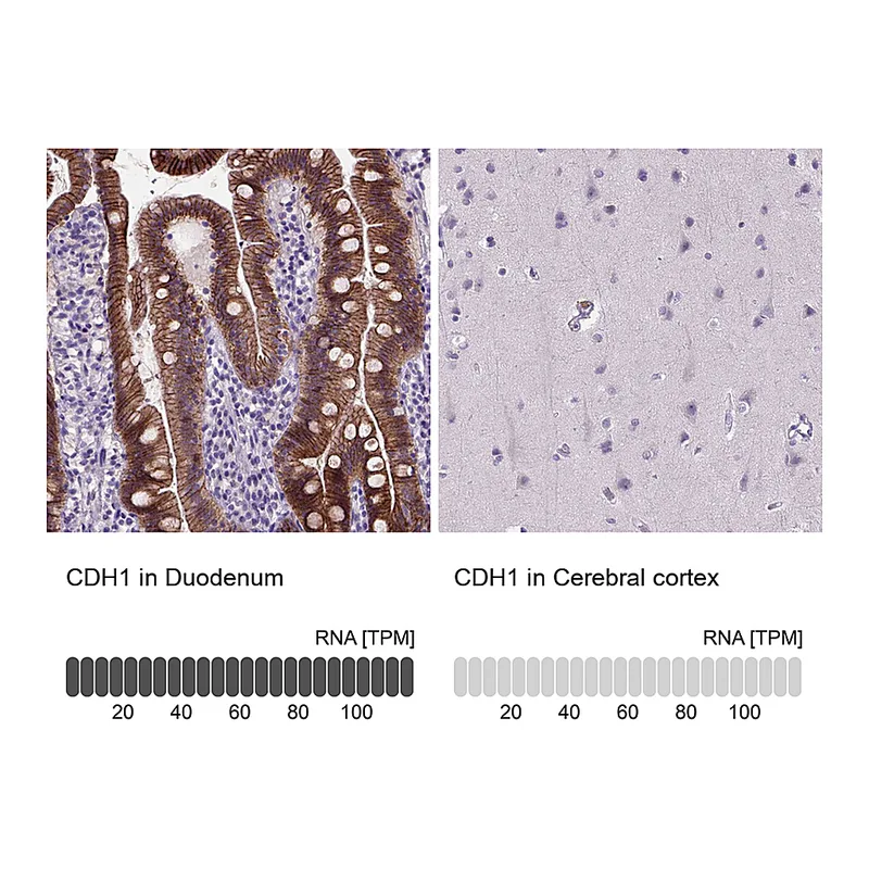 Atlas Antibodies Anti-CDH1 Antibody