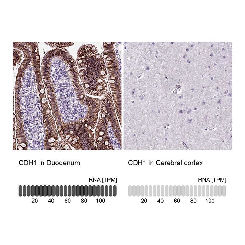 Atlas Antibodies Anti-CDH1 Antibody