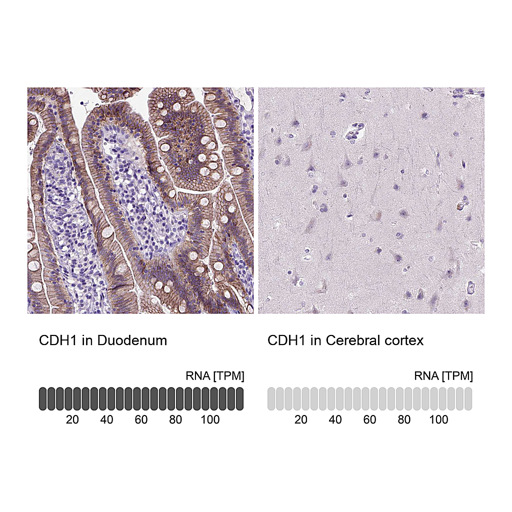 Atlas Antibodies Anti-CDH1 Antibody