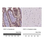 Atlas Antibodies Anti-CDH1 Antibody