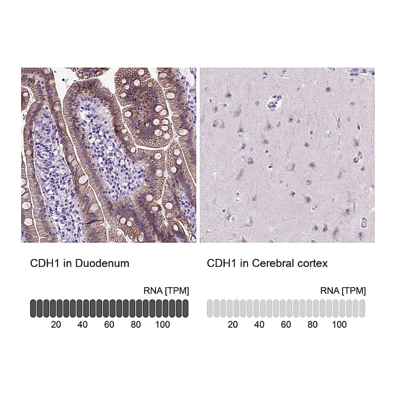 Atlas Antibodies Anti-CDH1 Antibody
