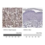 Atlas Antibodies Anti-CDH2 Antibody