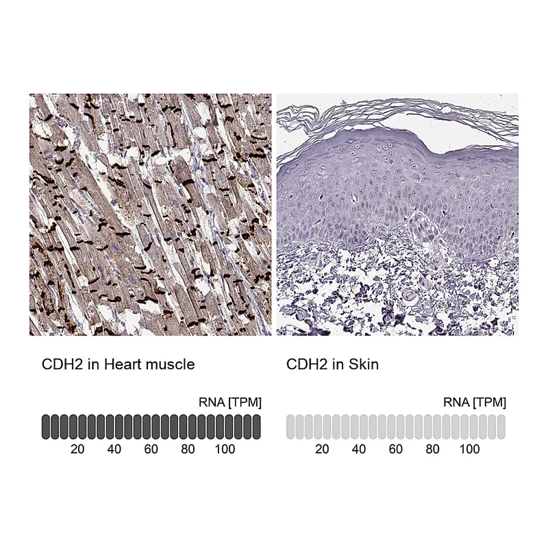 Atlas Antibodies Anti-CDH2 Antibody