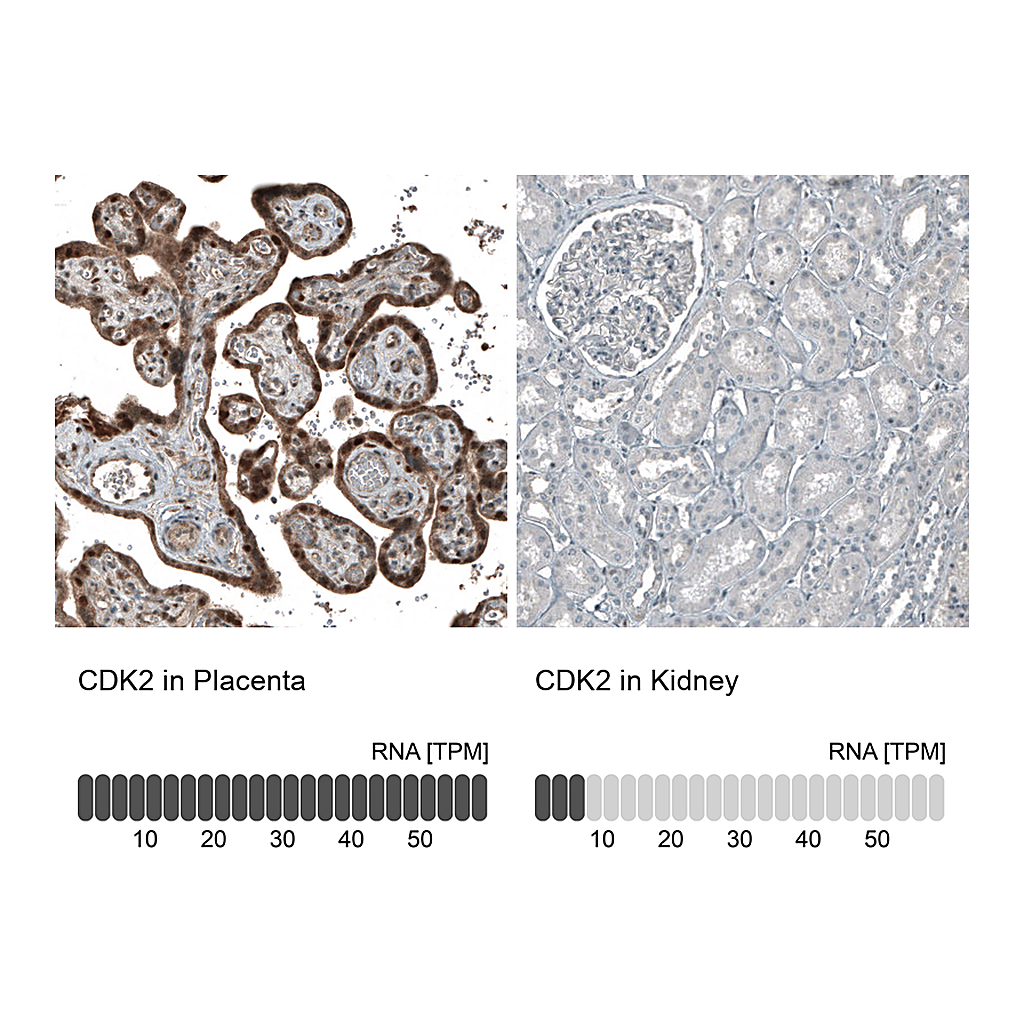 Atlas Antibodies Anti-CDK2 Antibody