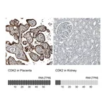 Atlas Antibodies Anti-CDK2 Antibody