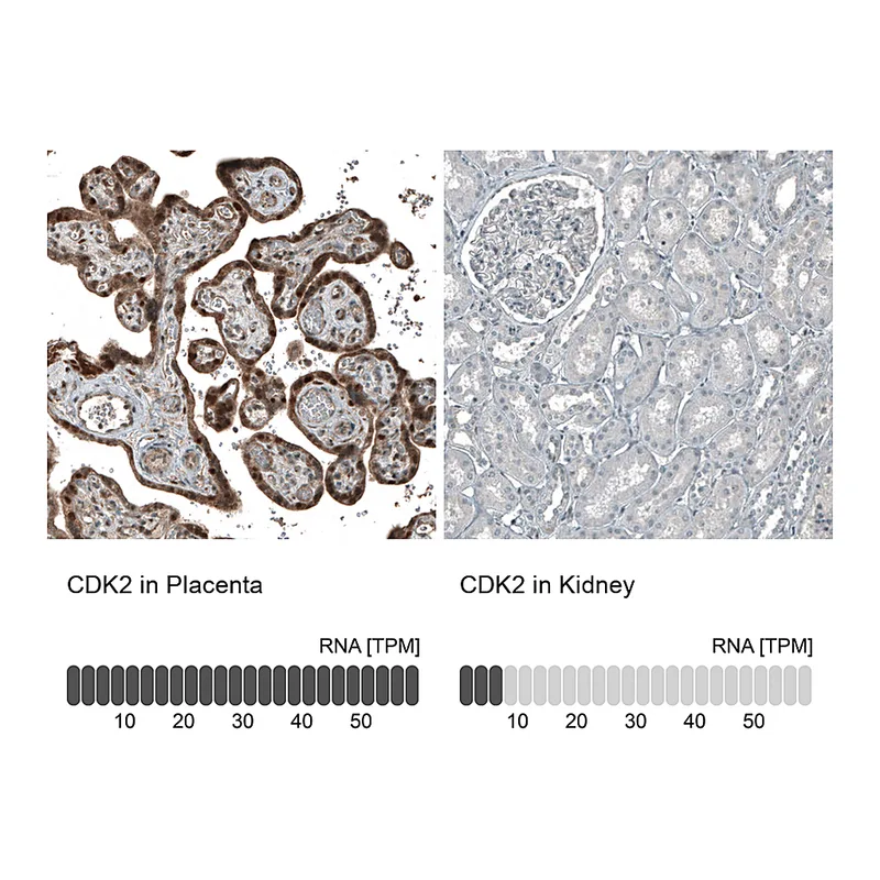 Atlas Antibodies Anti-CDK2 Antibody
