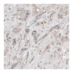 Atlas Antibodies Anti-CDK5RAP2 Antibody
