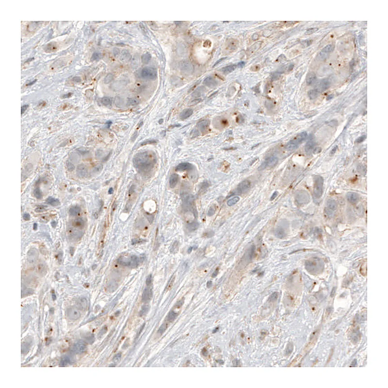 Atlas Antibodies Anti-CDK5RAP2 Antibody