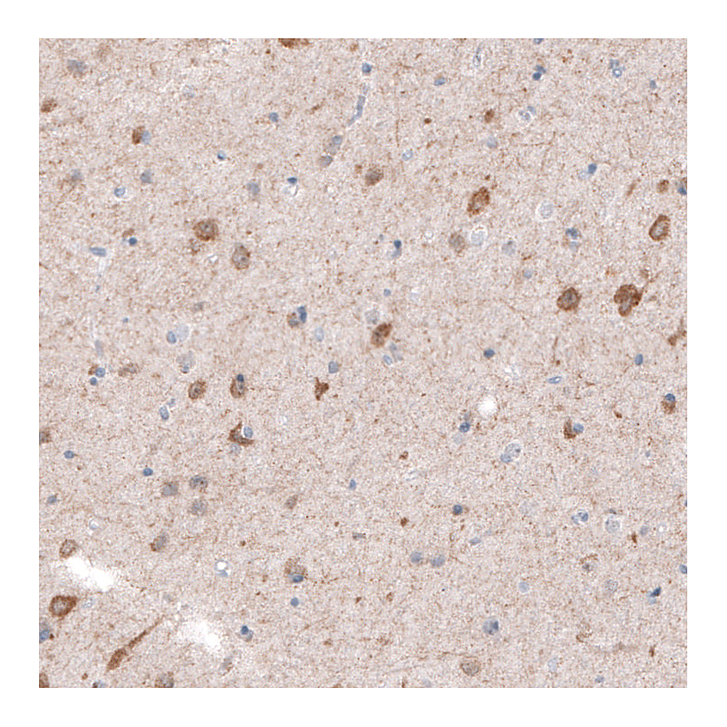Atlas Antibodies Anti-CDKL5 Antibody