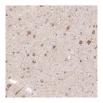 Atlas Antibodies Anti-CDKL5 Antibody