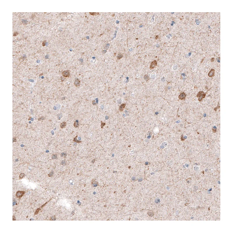Atlas Antibodies Anti-CDKL5 Antibody