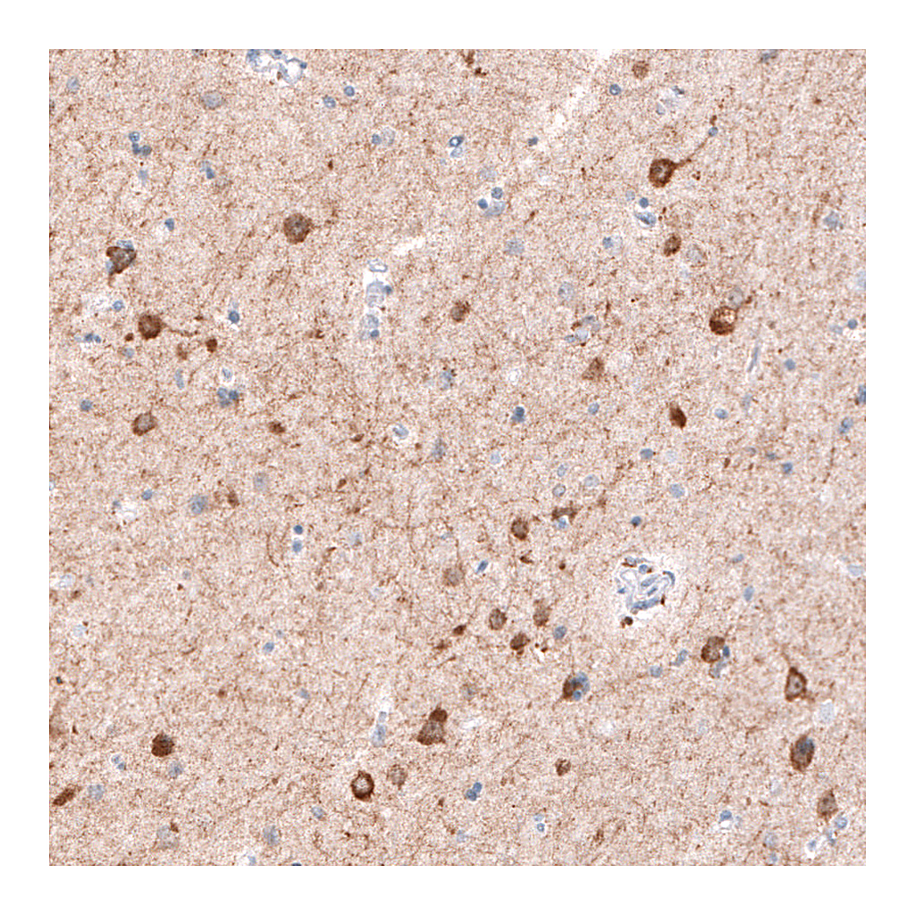 Atlas Antibodies Anti-CDKL5 Antibody