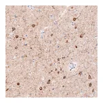 Atlas Antibodies Anti-CDKL5 Antibody