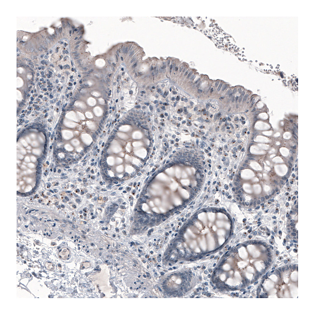 Atlas Antibodies Anti-CEP350 Antibody