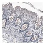 Atlas Antibodies Anti-CEP350 Antibody