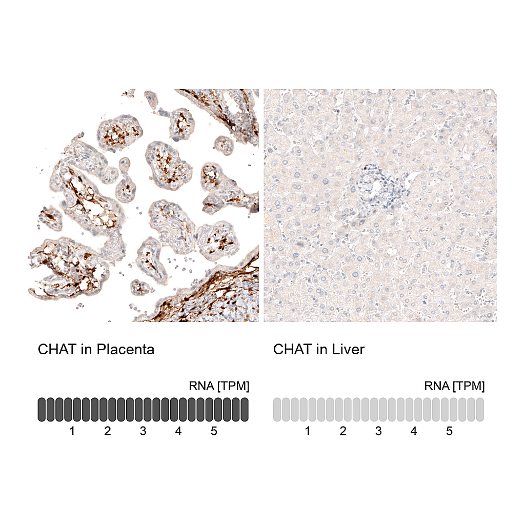 Atlas Antibodies Anti-CHAT Antibody