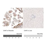 Atlas Antibodies Anti-CHAT Antibody